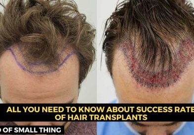 Hair Transplant Procedure